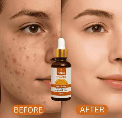 Relax Vitamin C Daily Face Serum – Brightening, Anti-Aging & Hydrating Formula For Healthy Radiant Skin (30ml)